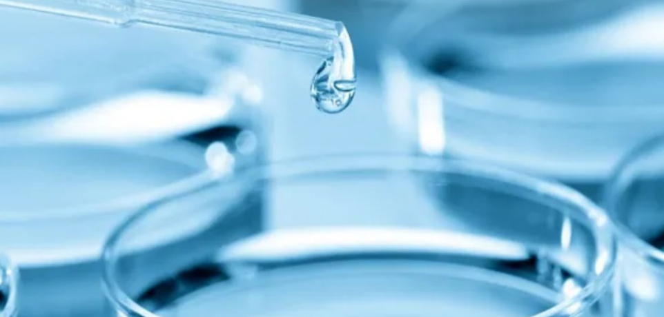 Legionella Risk Assessment Company Winchester